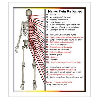 Wall Art  Posters  Nerve Pain Referred Poster
