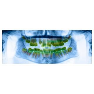 Wall Art  Posters  Dental X ray Poster