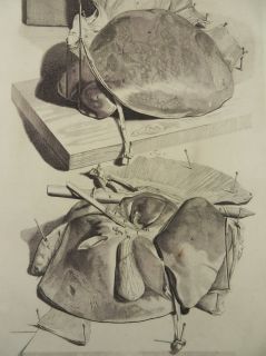 ANATOMIE MEDIZIN LEBER 2x KUPFERSTICH BIDLOO 1685