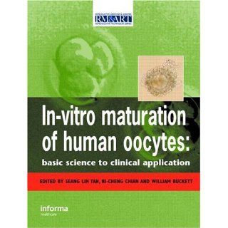 In Vitro Maturation of Human Oocytes (Reproductive Medicine & Assisted