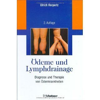 Ödeme und Lymphdrainage Ulrich Herpertz Bücher